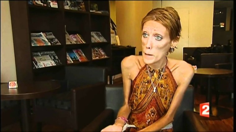 Изабелла Каро поправилась