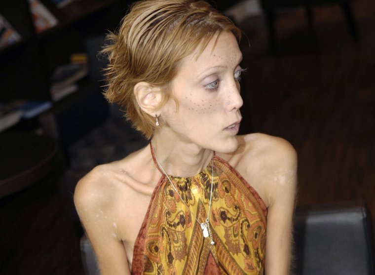 Изабель Каро французская модель