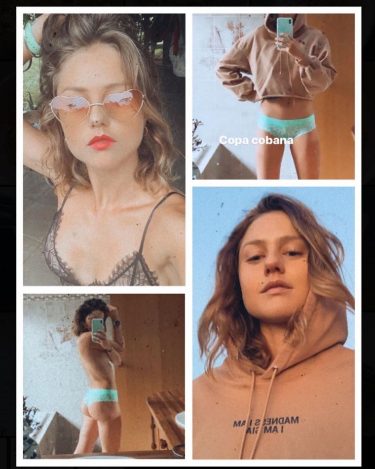 Анна Каролина Рестон анорексия