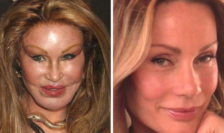 Страшные пластические операции