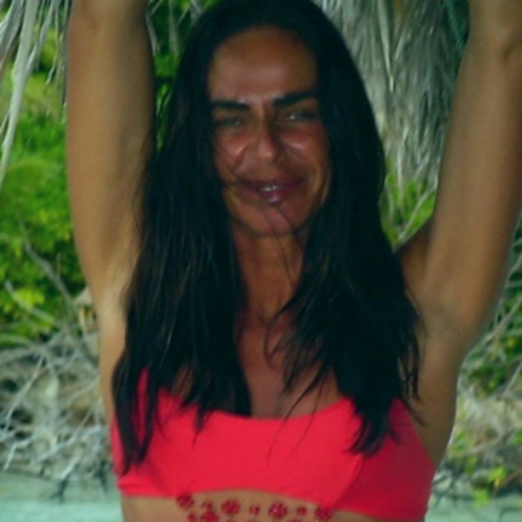 Михаэла романини до и после пластики