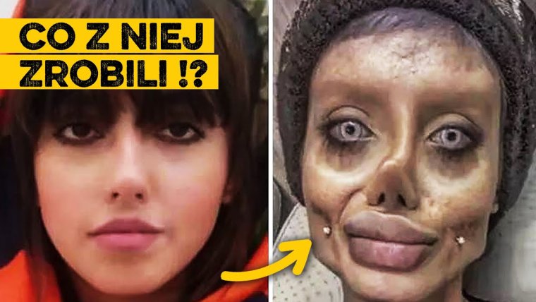 Меган Фокс акне