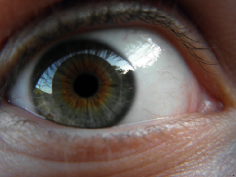 Серо буро козявчатый цвет глаз