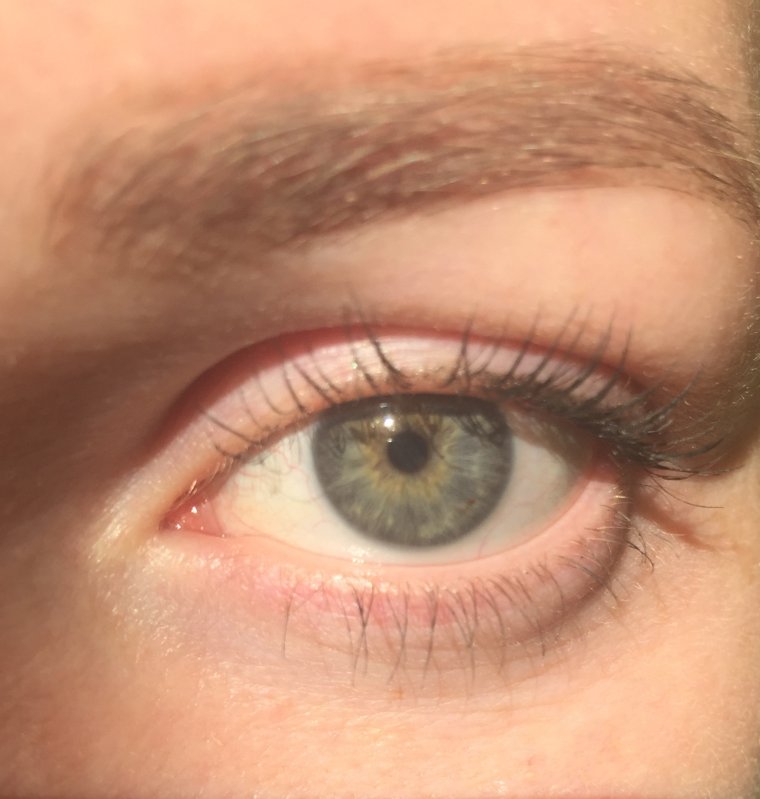 Серабуромалиновые глаза