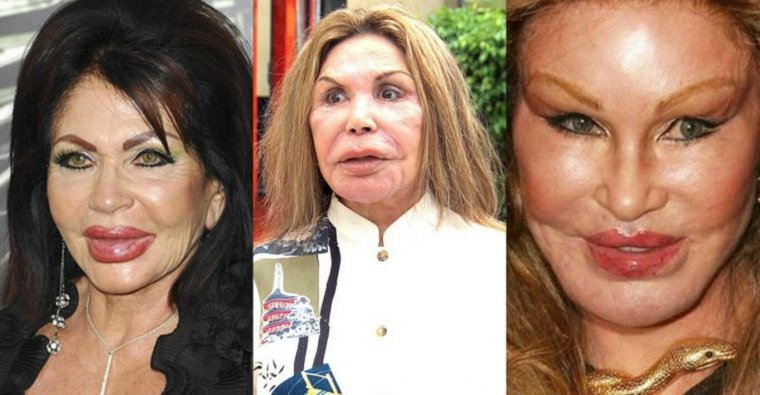 Некдачеая поастика лицпп