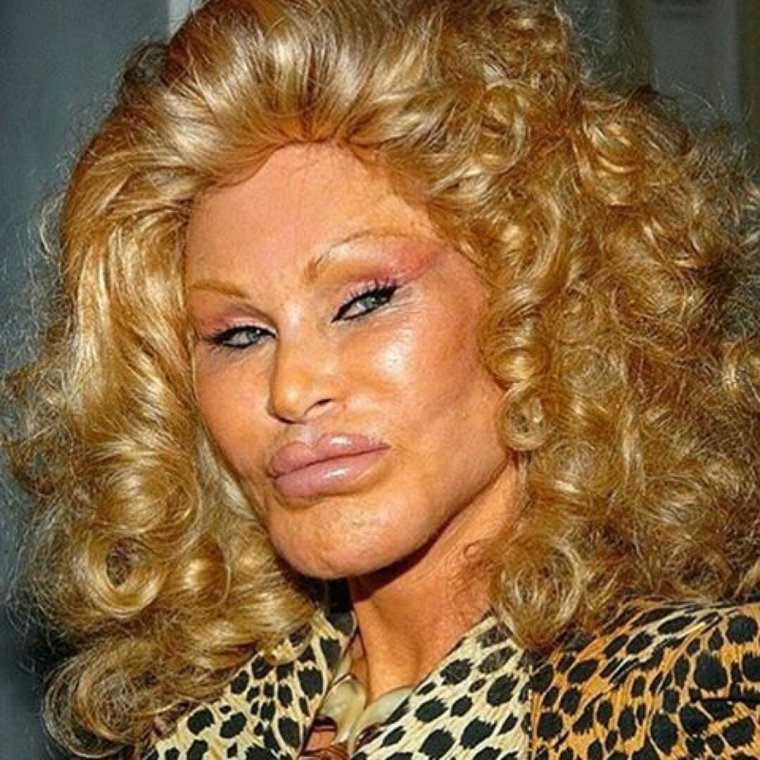 Джоселин Вильденштейн