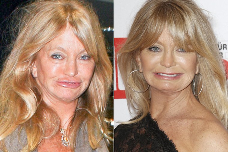 Голди Хоун пластические операции