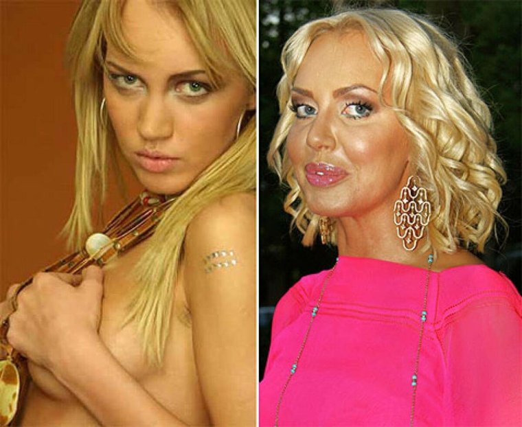 Маша Малиновская до пластики