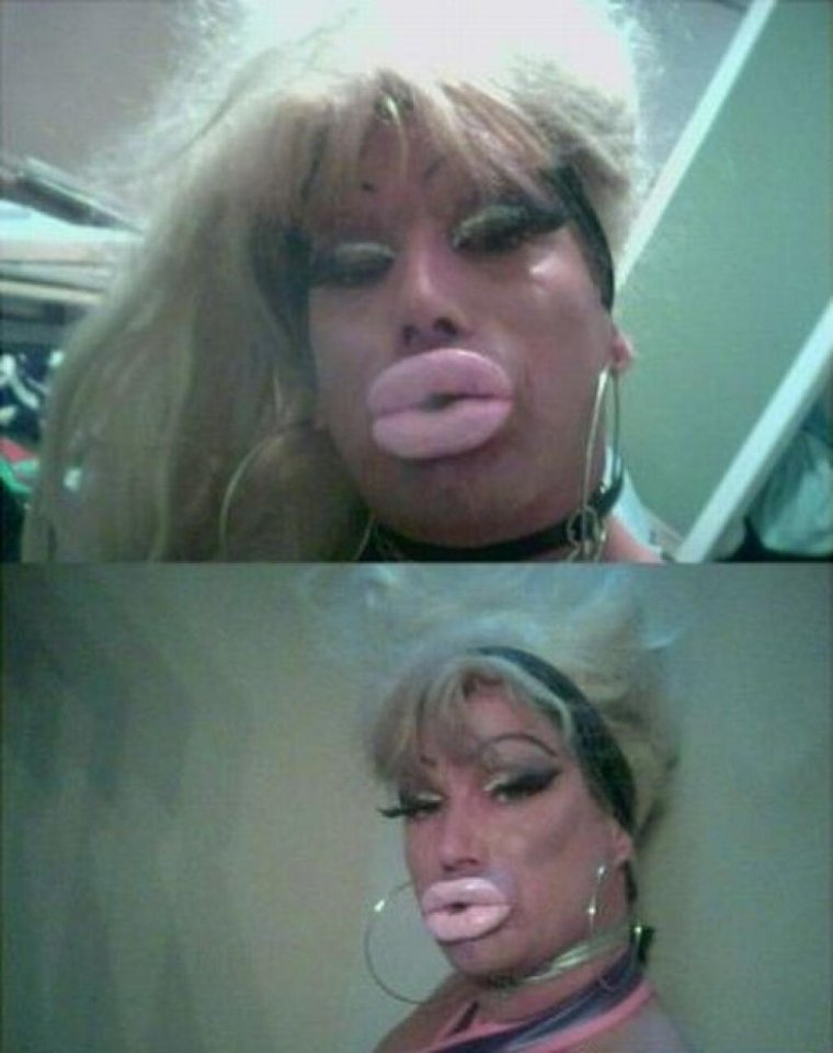 Малиновская жертва пластической хирургии