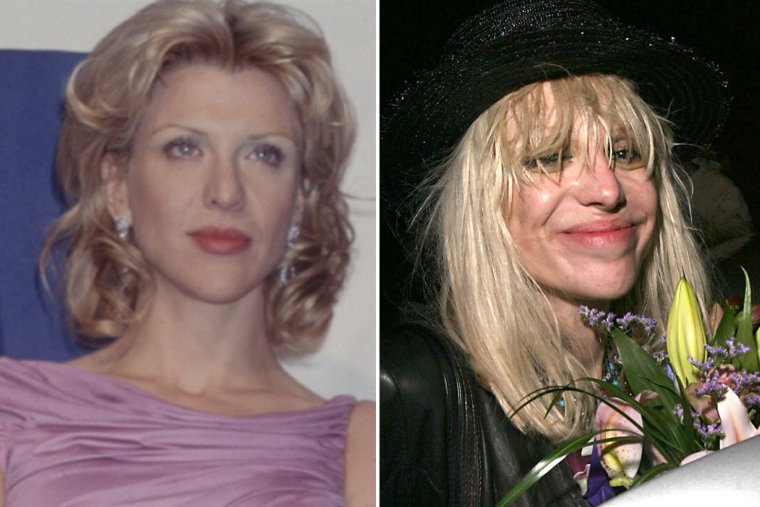 Неудачная пластика лица