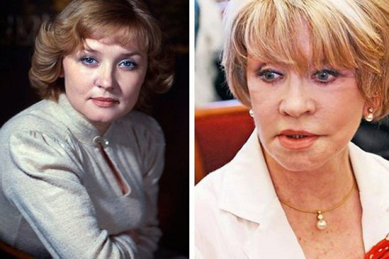 Вера Алентова после пластики