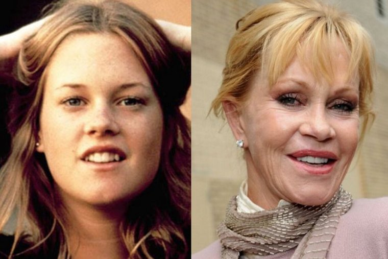 Мелани Гриффит до пластики