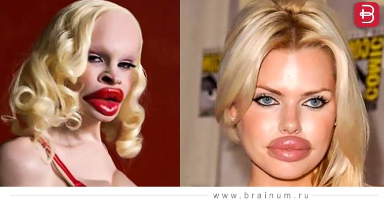 Девушки с пластическими операциями