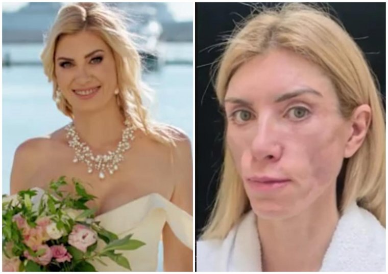 Модель после неудачной операции