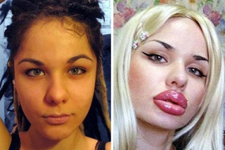 Кристина Рэй до пластики