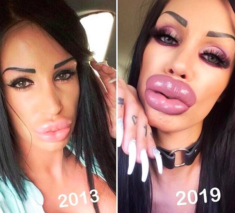 Накаченные губы