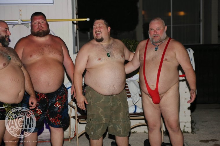 Люди с морбидным ожирением