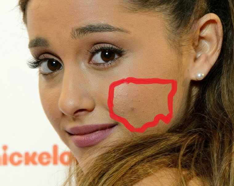 Певица с родинкой возле носа