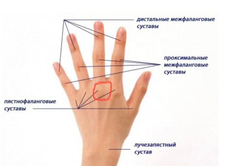 Проксимальные межфаланговые суставы