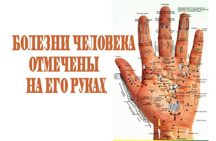 Акупунктурные точки на ладони