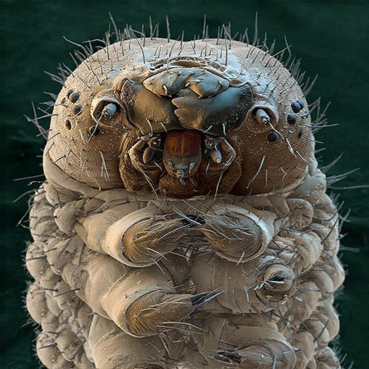 Микроскопические клещи демодекс