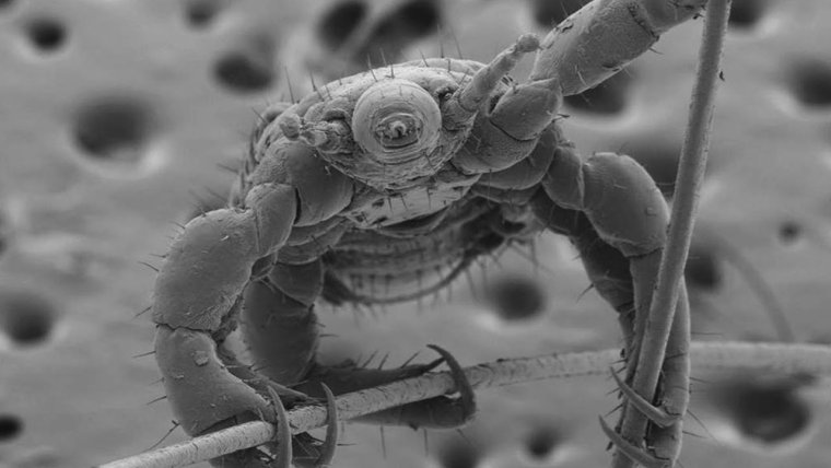 Тихоходка в микроскопе