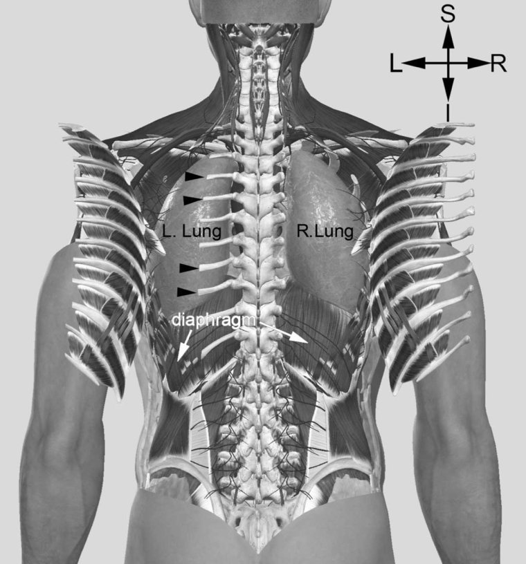 Распятие Кровавый Орел