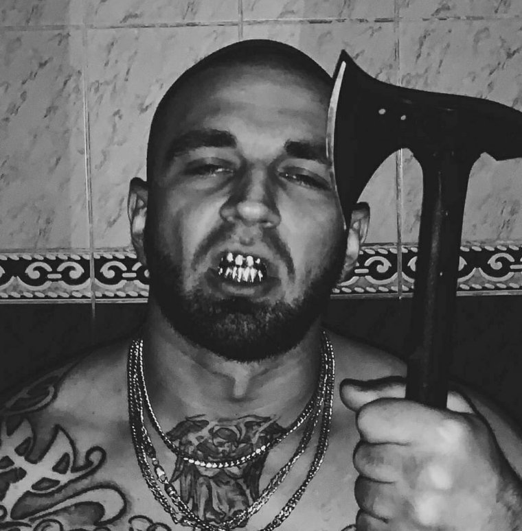 Никита Раскольников зубы