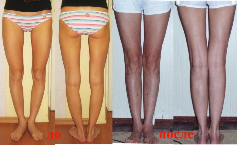 Форма ног у женщин