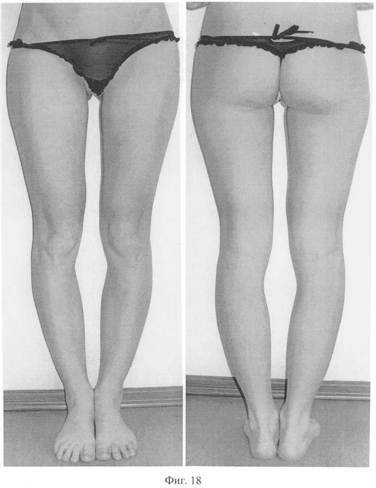 Девушка с кр выми ногами