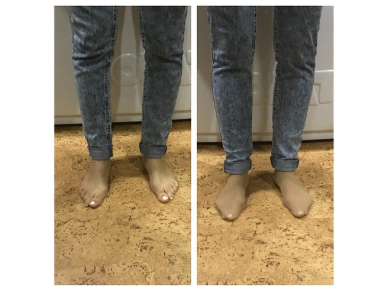 Задняя сторона ноги