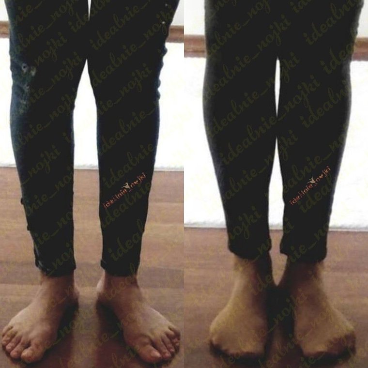 Круропластика Соколов