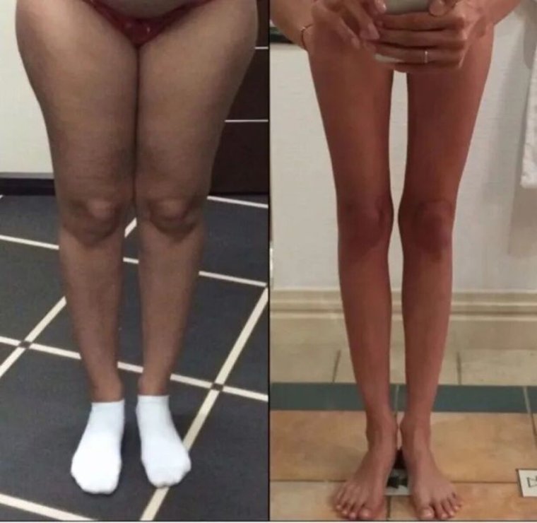 Красивая форма ног