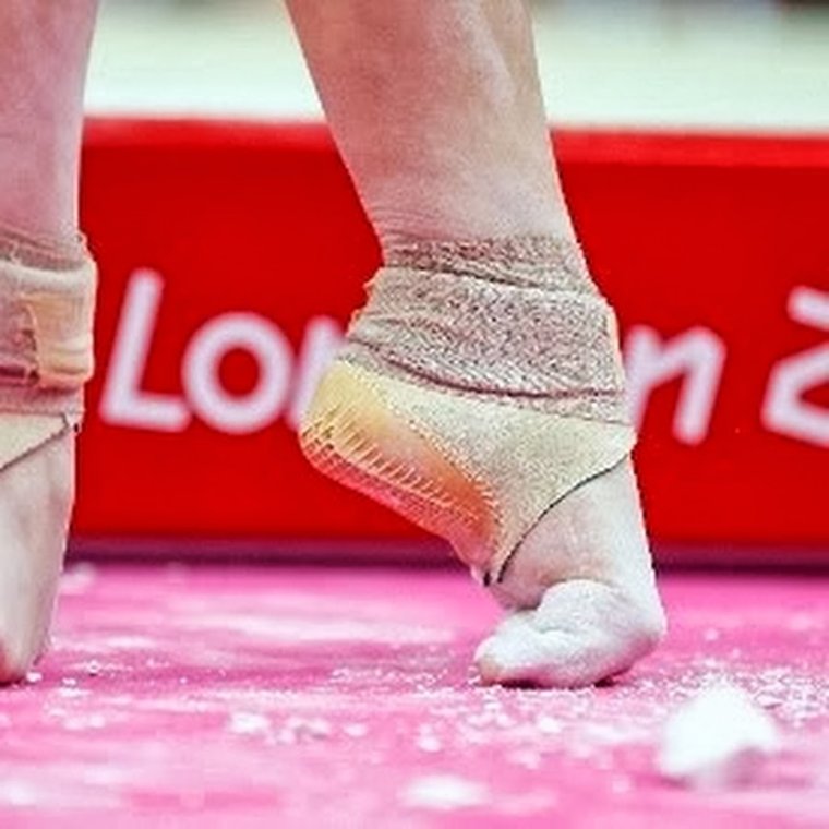 Удлинение ног аппаратом Илизарова