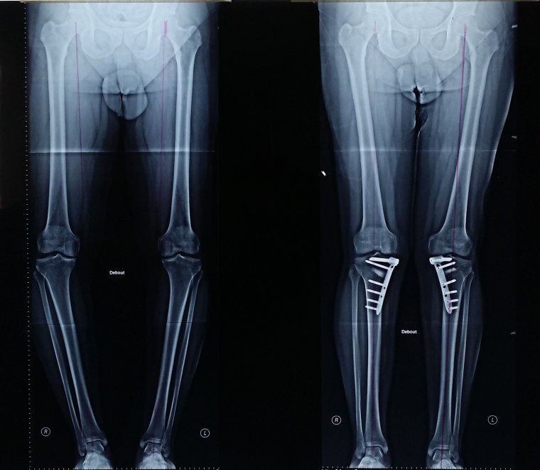 Х образные ноги одежда женская