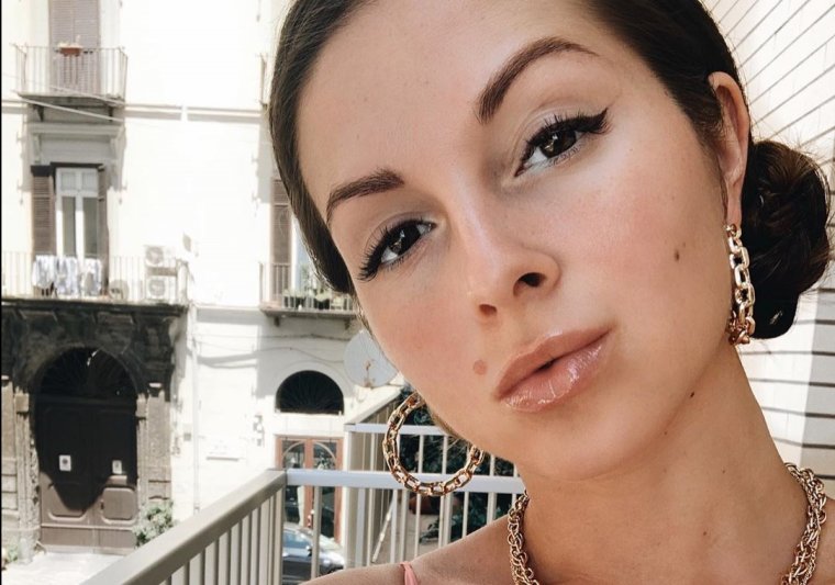 Нюша родинка на лице