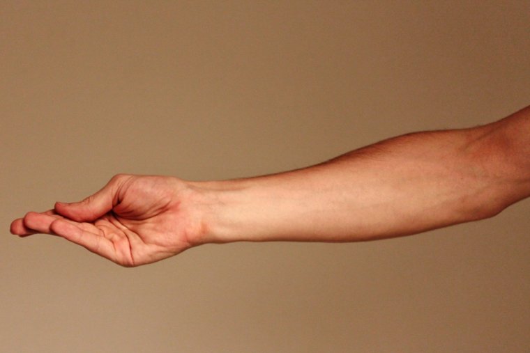 Рука предплечье