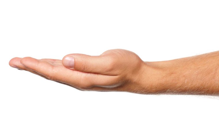 Рука вид сбоку