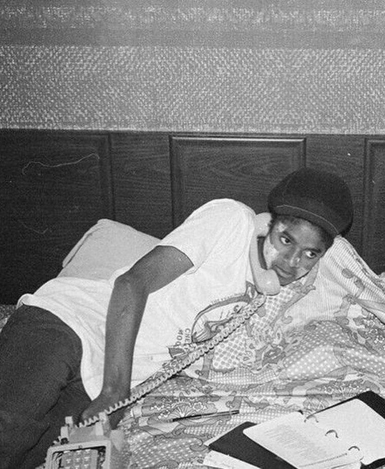 Майкл Джексон в больнице 1984