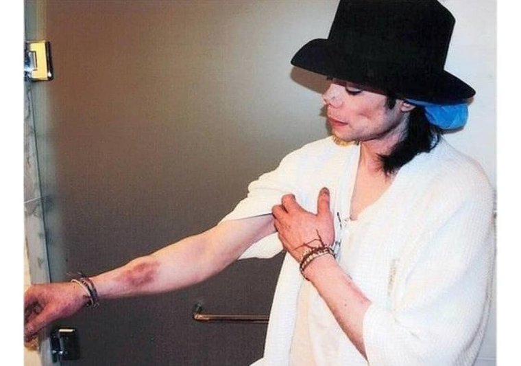 Майкл Джексон наркозависимость