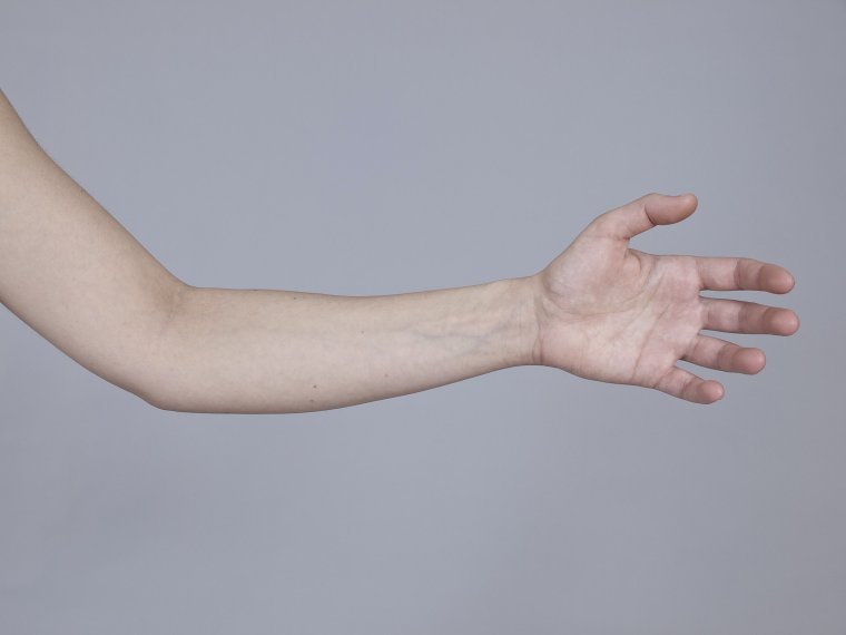 Рука предплечье