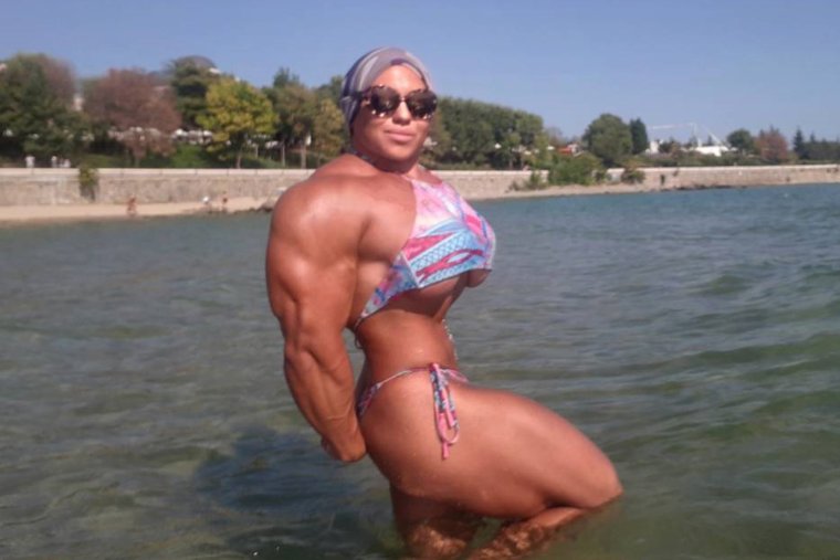 Наталья Кузнецова лысая