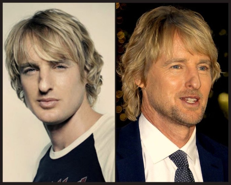 Оуэн Уилсон нос до и после