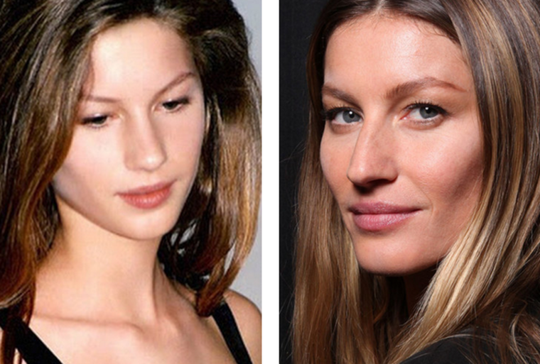 Жизель Бюндхен до пластики