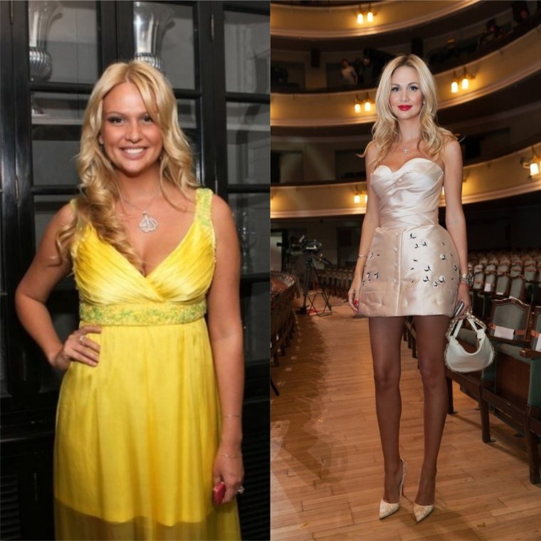 Лопырёва Виктория до пластики