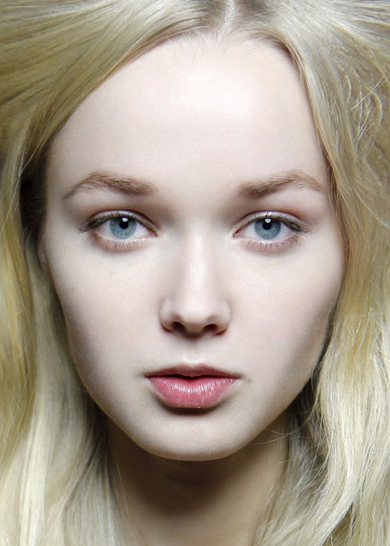 Нордид альбинос