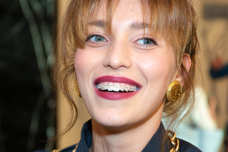 Регина Тодоренко брекеты