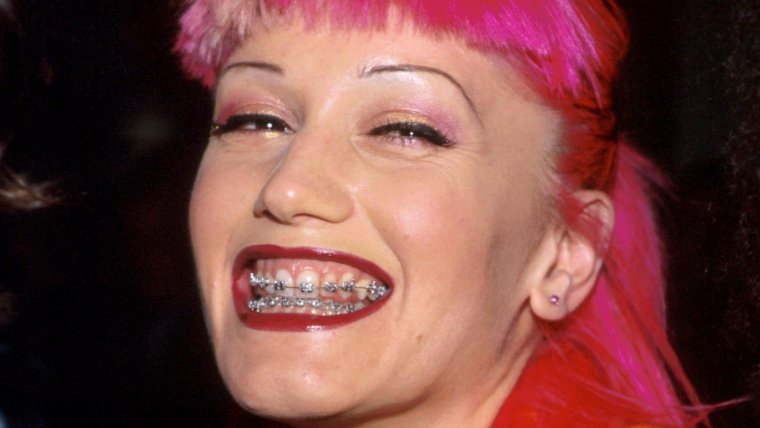 Гвен Стефани зубы