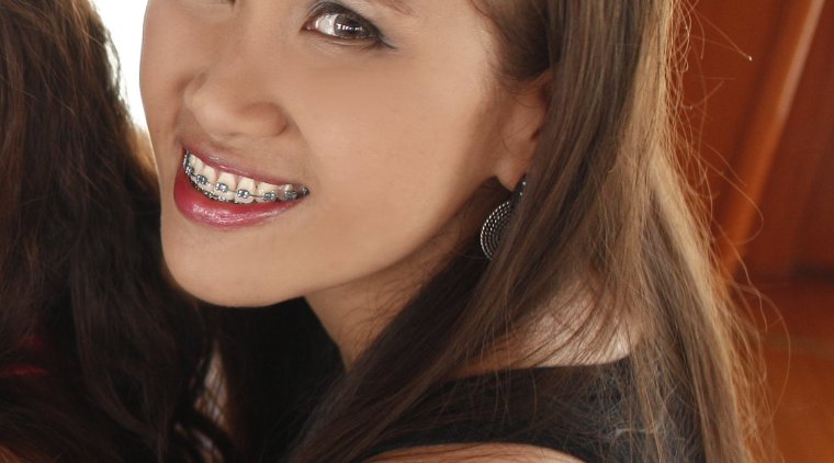 Девушка с брекетами