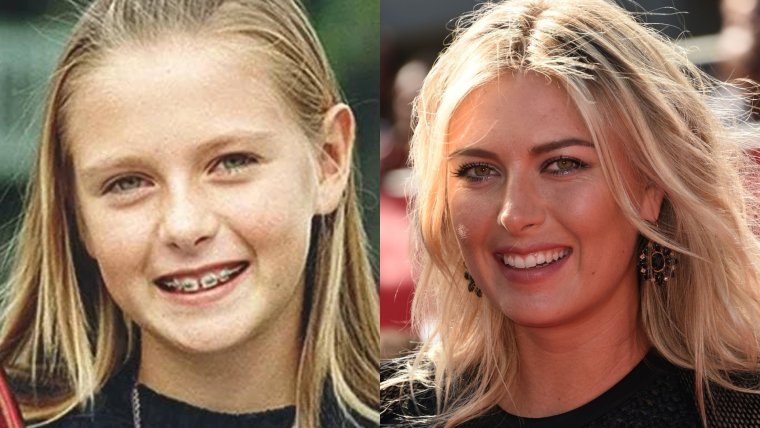 Брекитовый тренд без говняка